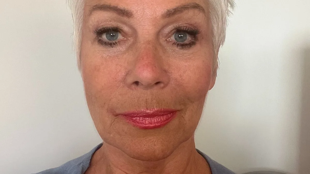 Denise Welch Praises £25 Neck Serum for 'Less Wrinkling' After Two Weeks