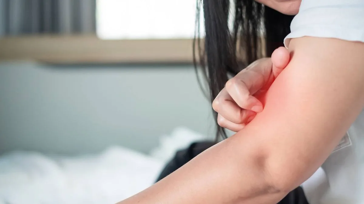 DWP Lists 24 Skin Conditions Eligible for PIP Payments
