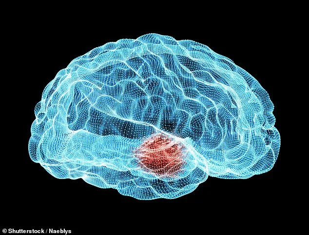 Moderate Exercise Five Times a Week May Reduce Alzheimer's Risk, Study Finds