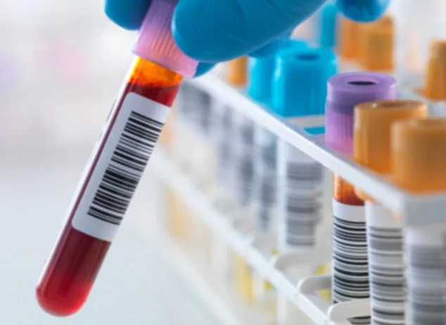 HIV Breakthrough: Antibody Neutralises 98% of Strains