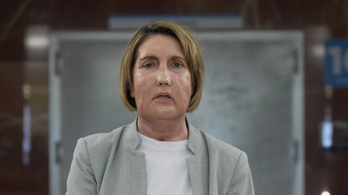 Woman Receives Full Face Transplant After Insect Bite in Canary Islands