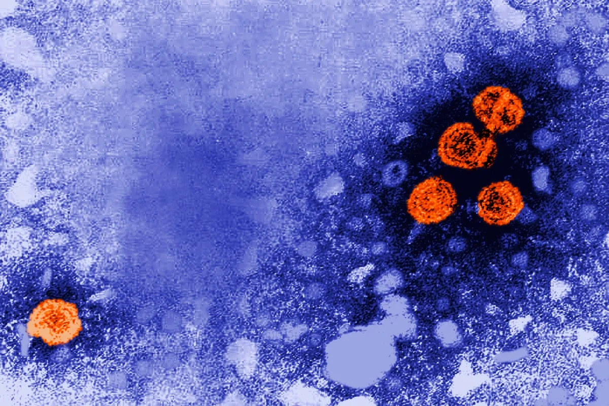 FDA fast-tracks hepatitis B drug after 'remarkable' trial results