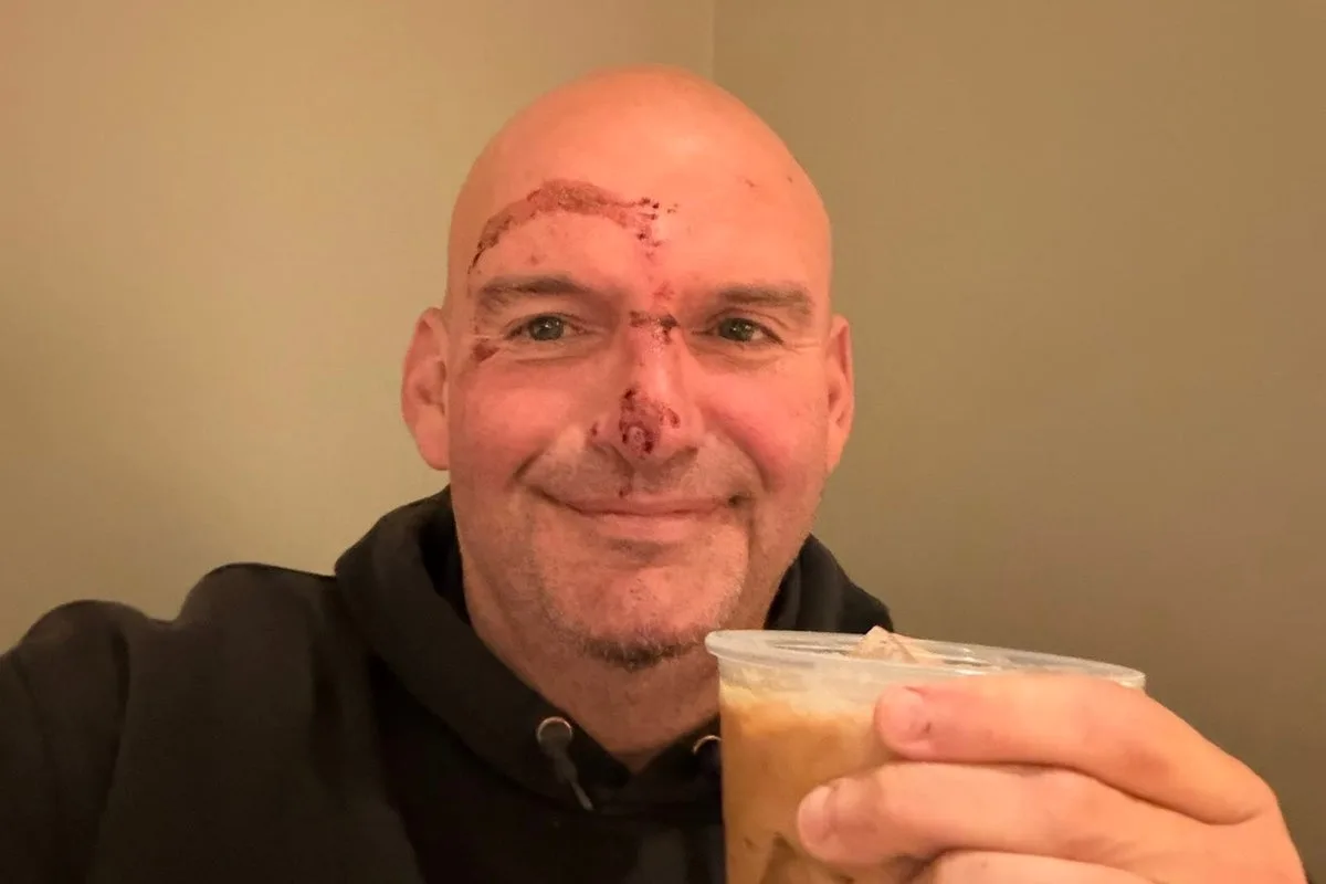 Fetterman Shows 20 Stitches After Hospital Discharge