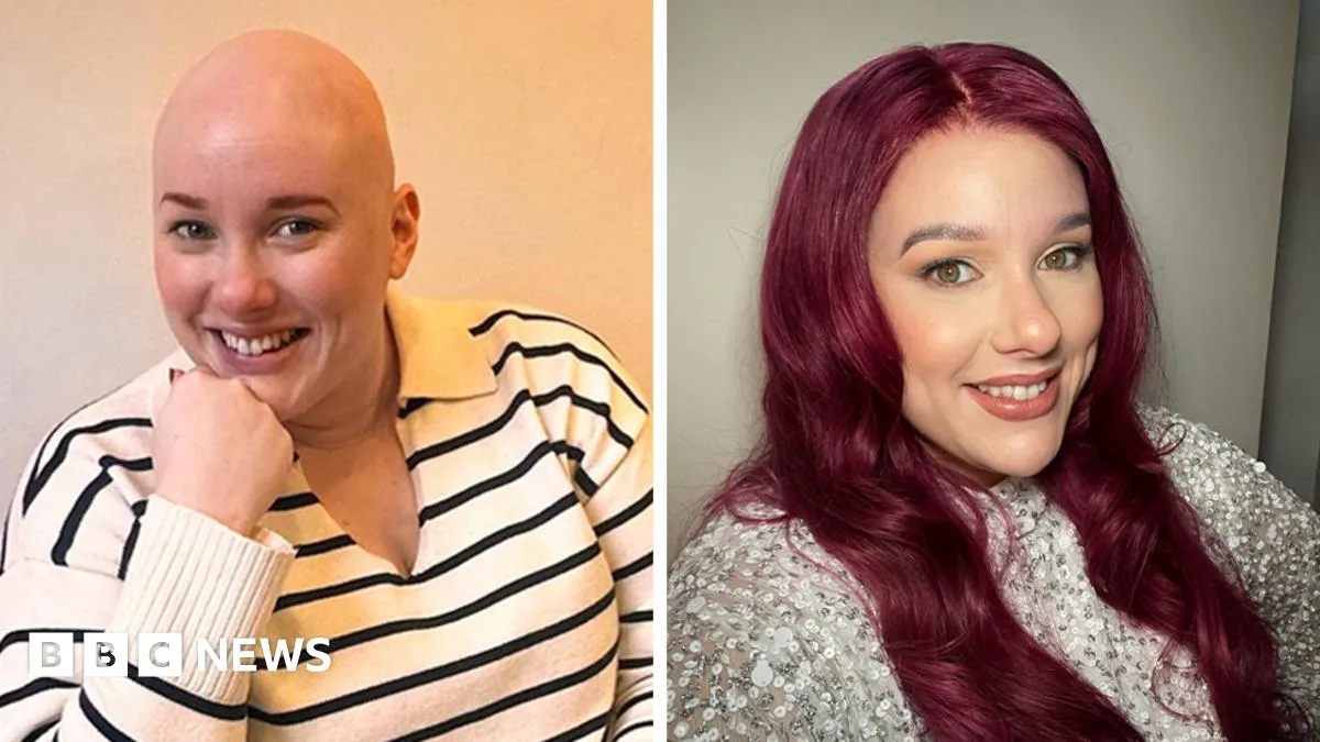 Gail Porter Praised for Wig Photoshoot as Alopecia Campaigners Stress Choice