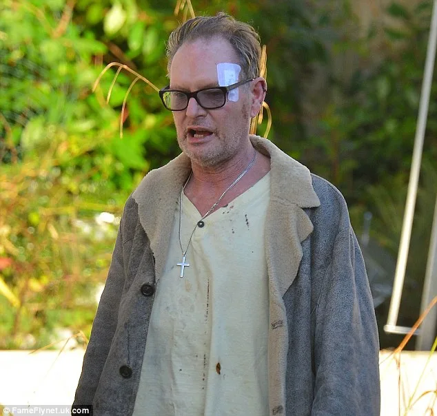 Paul Gascoigne Hospitalised After Hotel Incident, Shows Bruises and Stitches