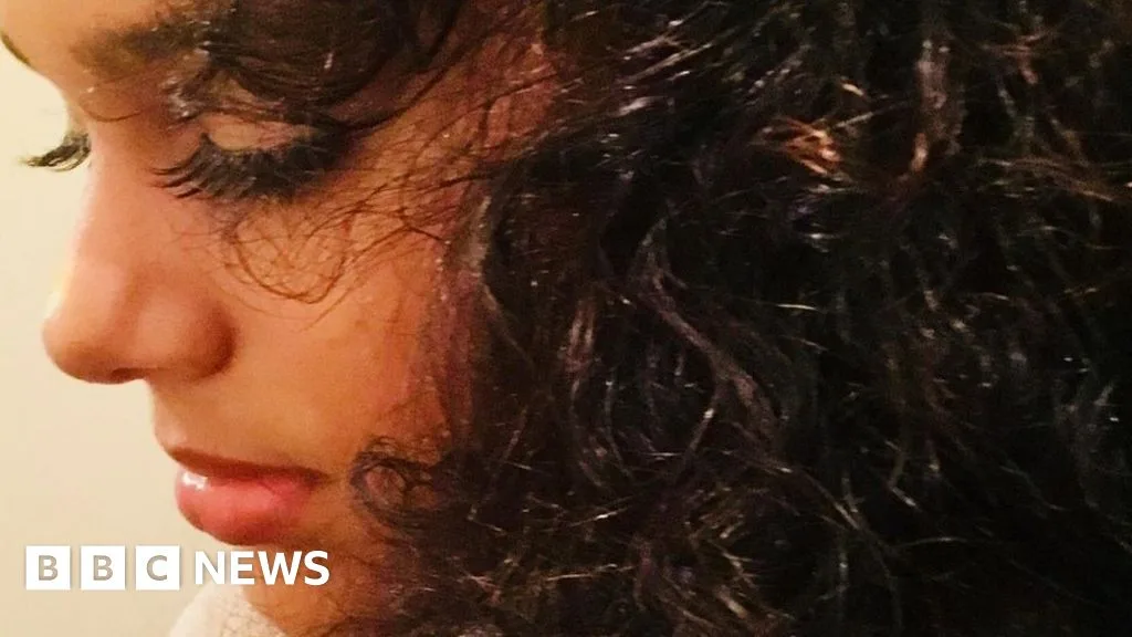 Girl, 13, Dies Day After Rare Cancer Diagnosis