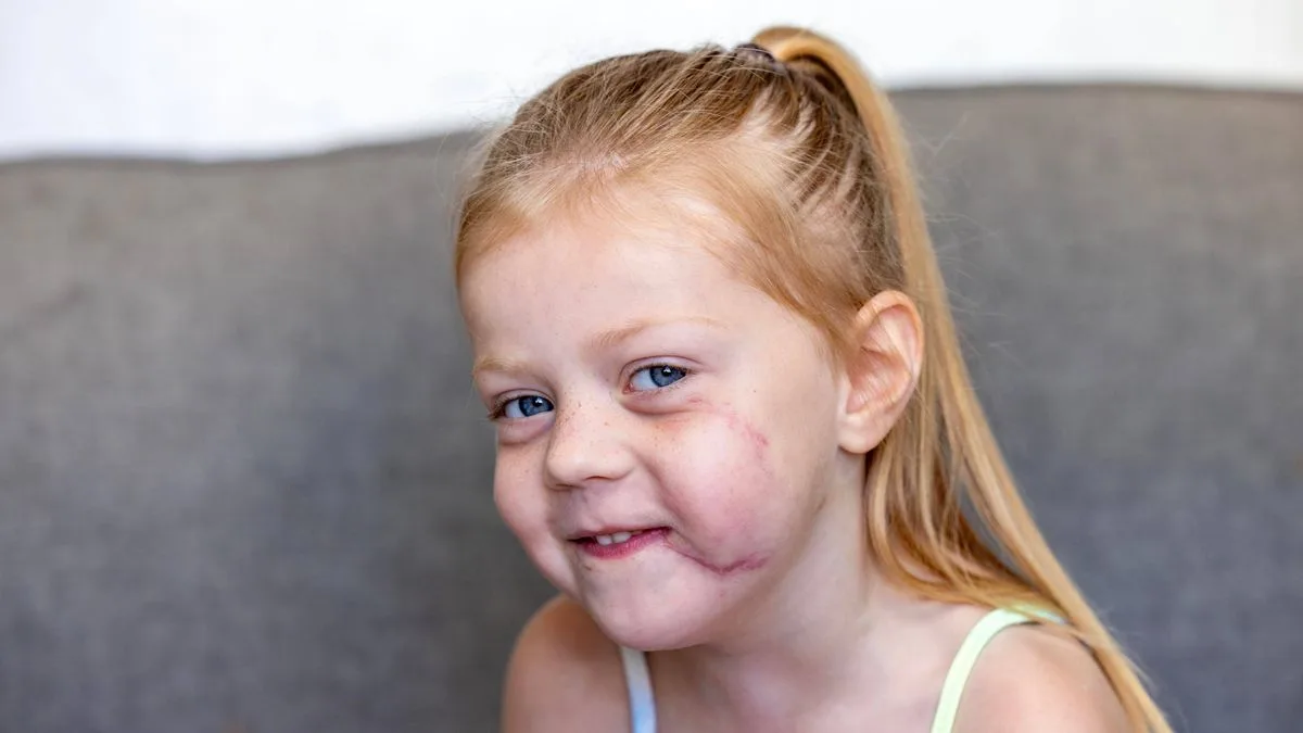 Girl's Life 'Changed Forever' After Vicious Bulldog Attack