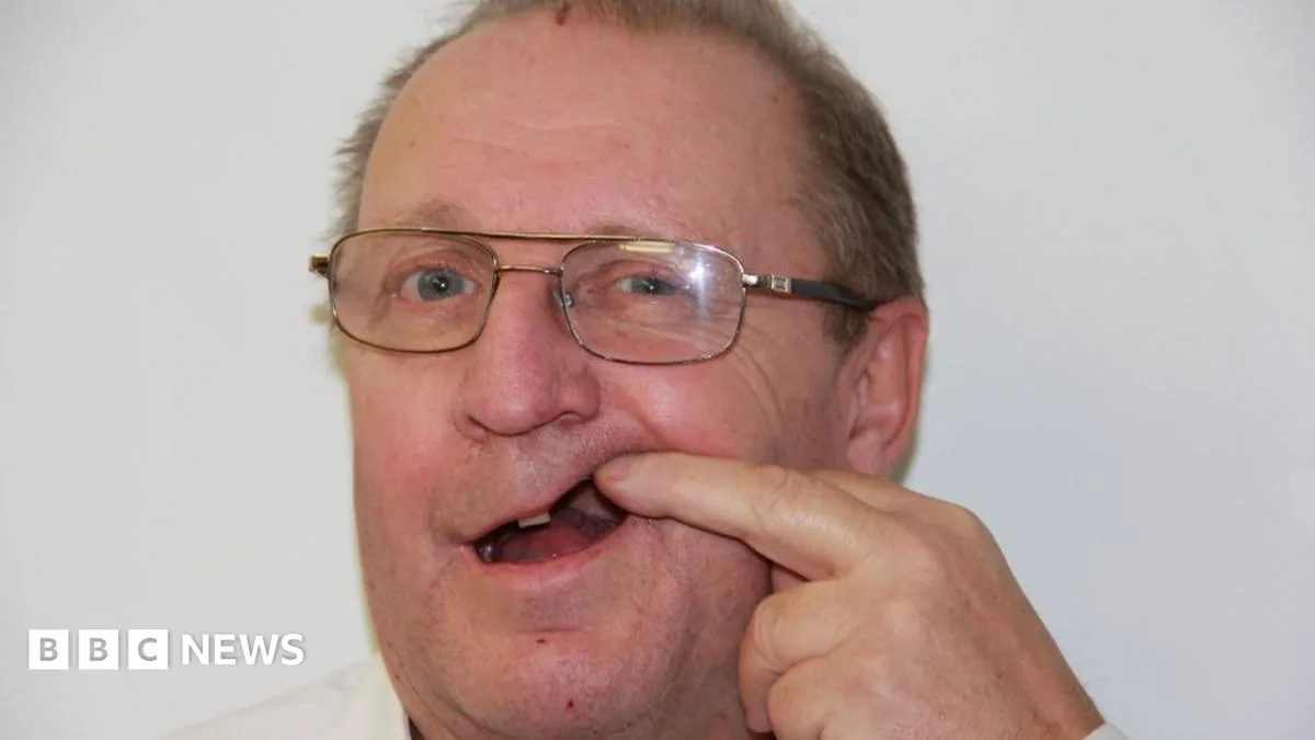 Man Pulls Own Tooth After 18-Month NHS Dentist Wait