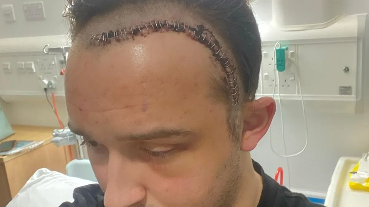 GP Blamed Headaches on Pill; It Was a Brain Tumour