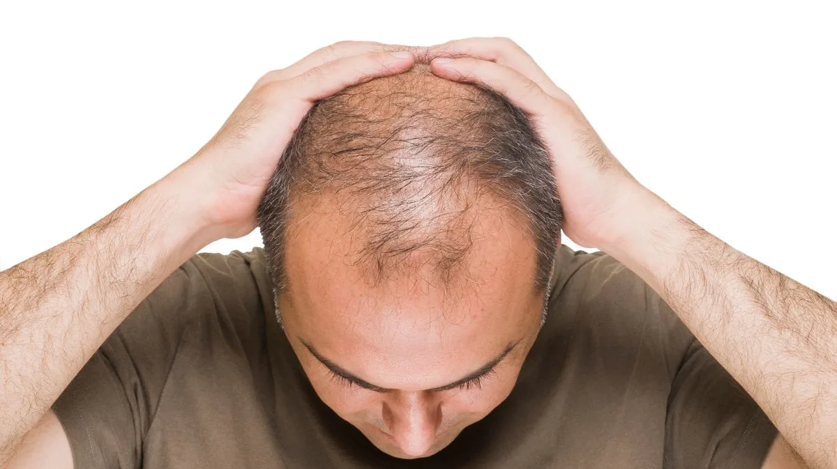 Hormone Discovery Could Revolutionise Hair Loss Treatment