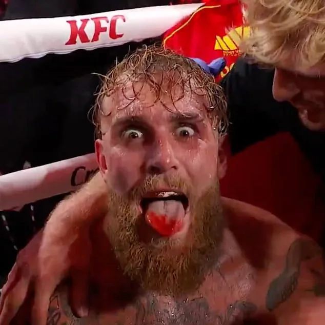 Jake Paul May Never Fight Again After Broken Jaw