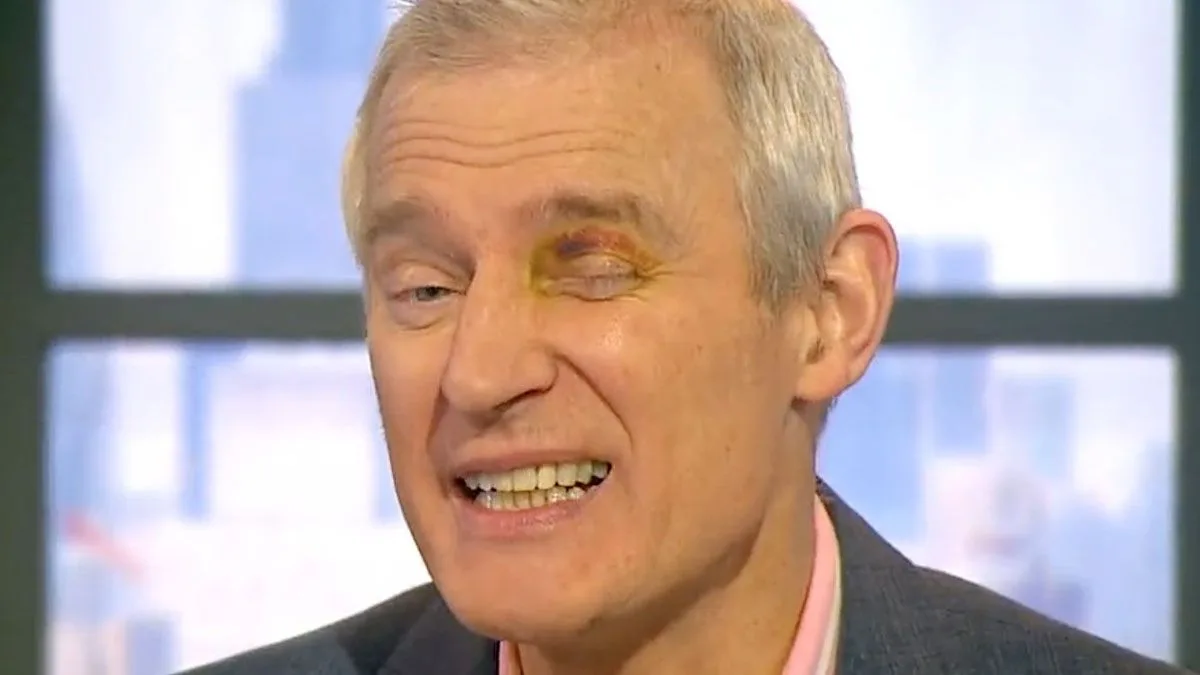 Jeremy Vine Returns to Work with Black Eye After Penny-Farthing Crash