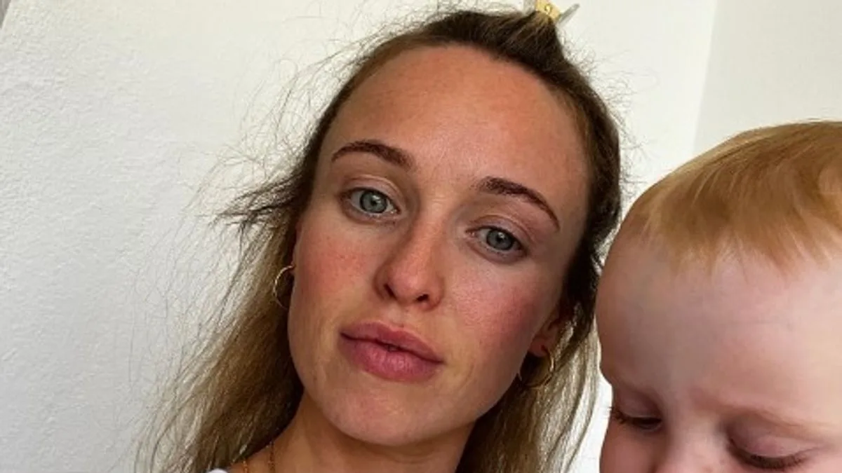 Jorgie Porter opens up about postpartum hair loss: 'I was not prepared'