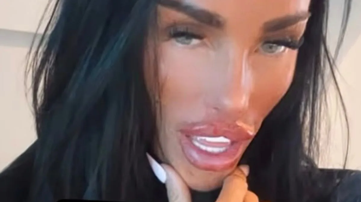 Katie Price Unveils New Lips and Surgery Plans After Split