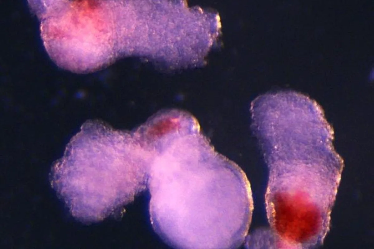 Lab-Grown Human Embryo Model Produces Blood Stem Cells in Leukaemia Breakthrough