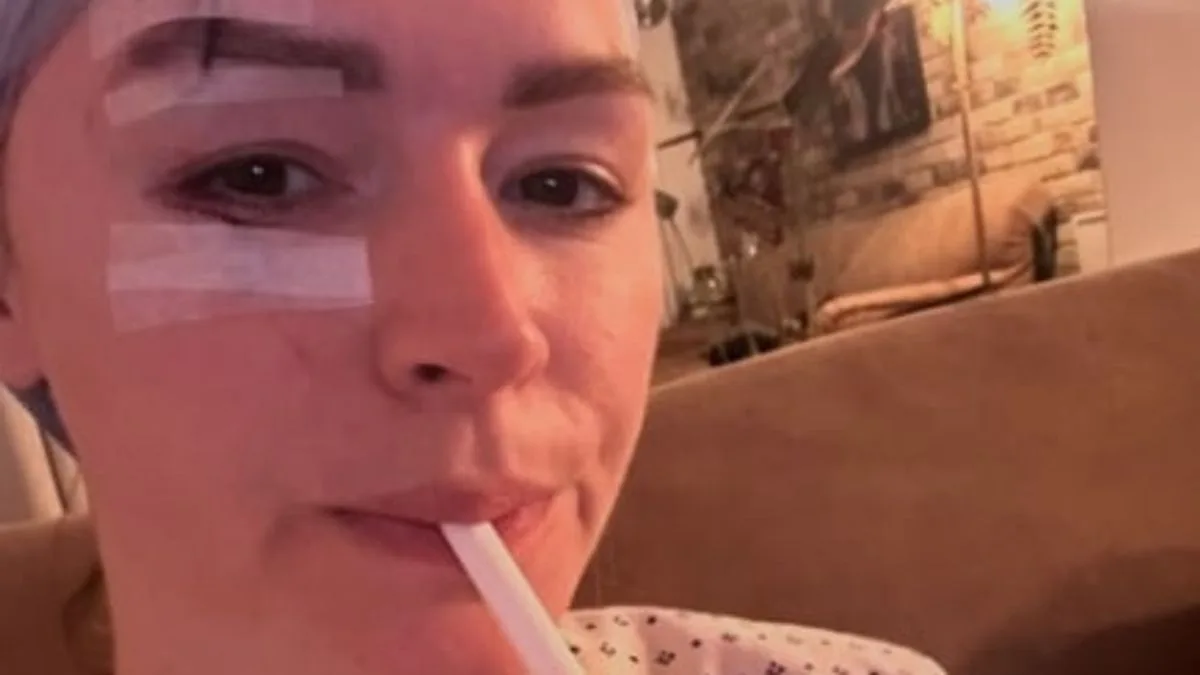 Laura Woods Shares Graphic Photos of Facial Injuries After Holiday Accident