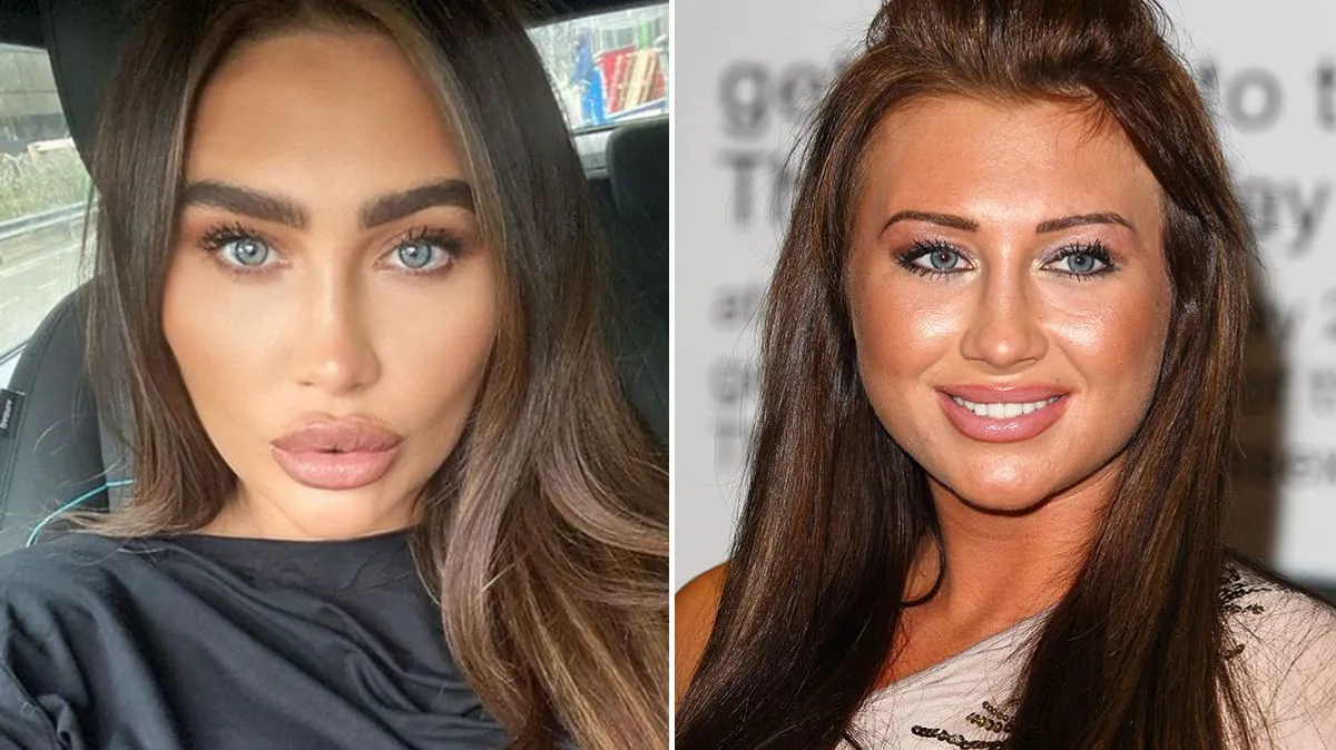 Lauren Goodger Plans to Reverse Cosmetic Surgery for Natural Look