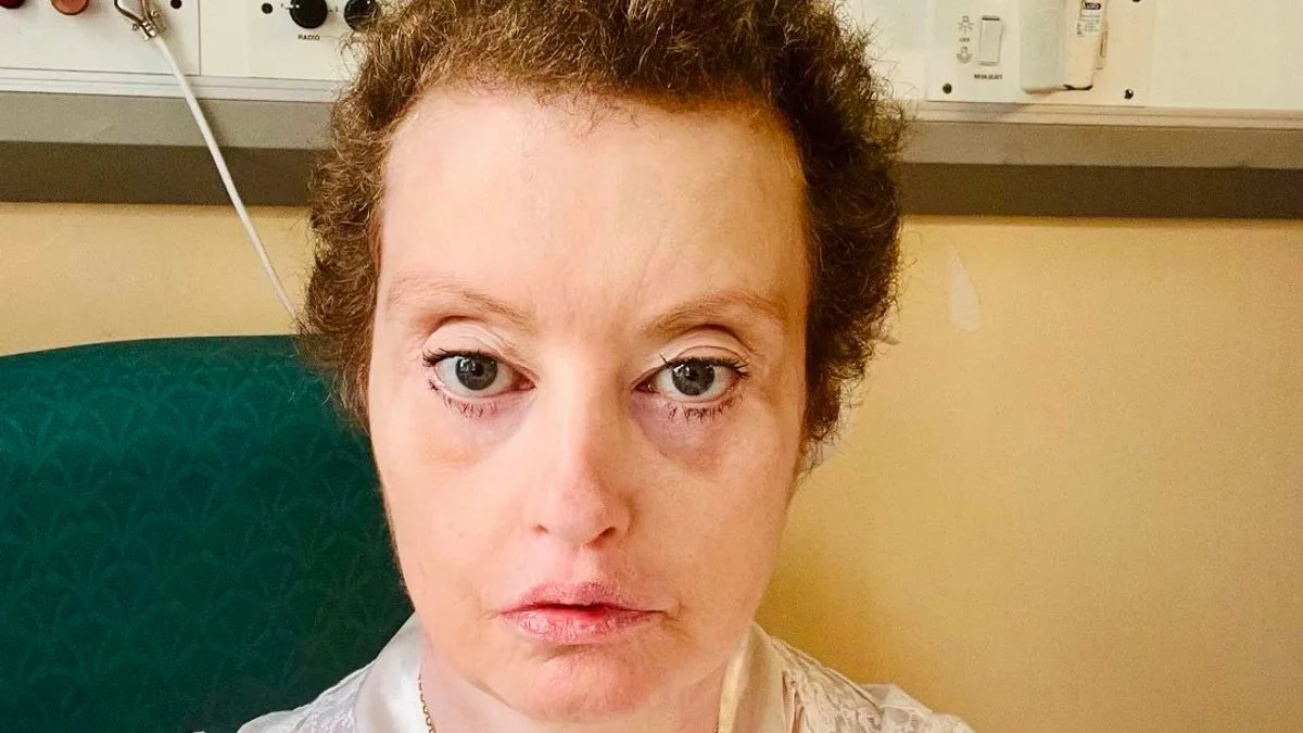 Lauren Harries Says Angels 'Brought Her Back from the Dead' After Brain Surgery