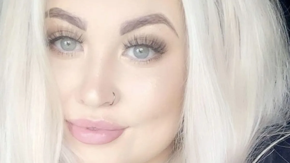Mum's 'Sausage Lips' After Filler Disaster: 'Traumatised' Woman Warns Others