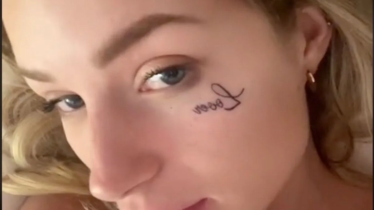 Lottie Moss Shows Off Facial Tattoo Removal Progress in Dubai