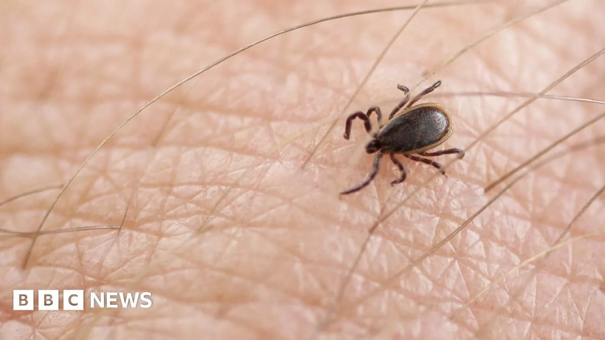Lyme Disease in the UK: 7 Critical Symptoms to Spot