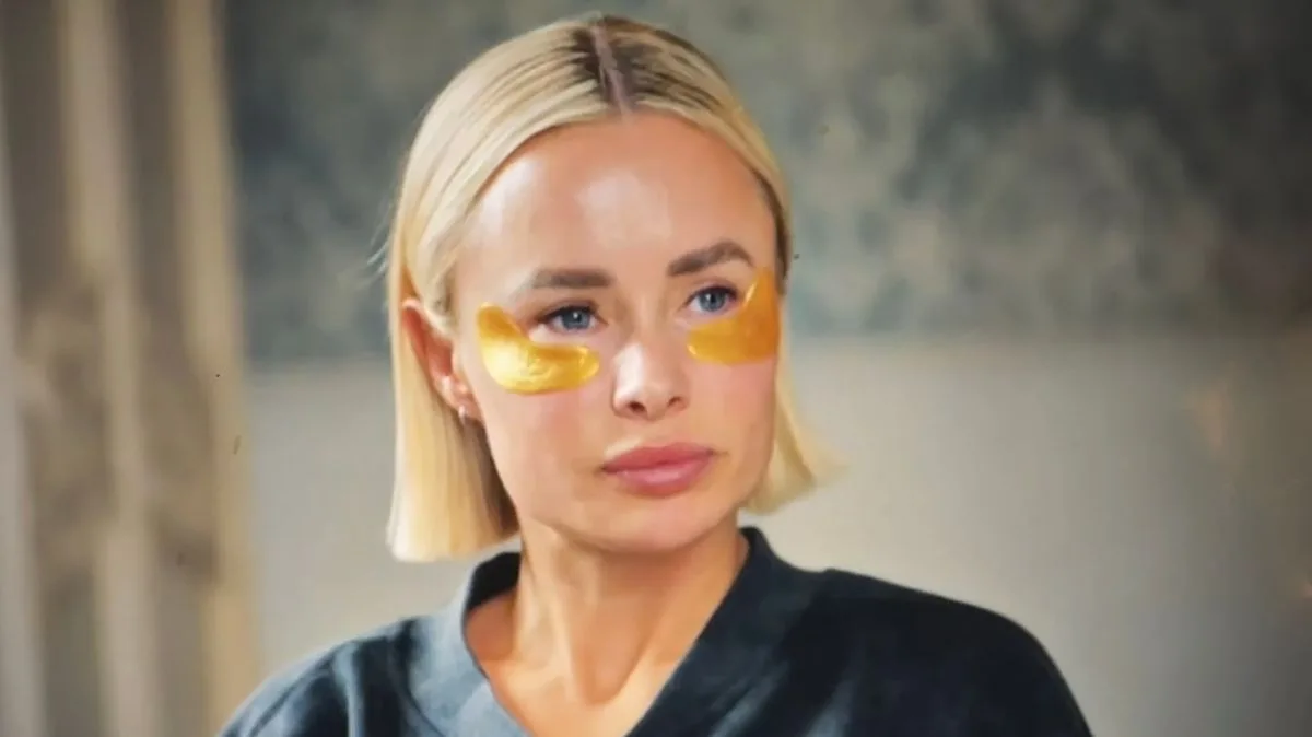 MAFS UK Viewers Baffled by 'Eye Slug' Beauty Patches Worn by Cast
