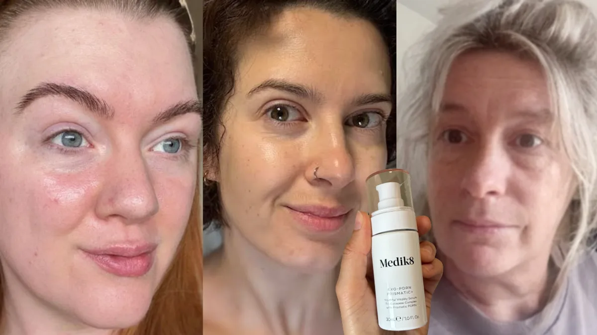 Medik8 Exo-PDRN Serum Review: Three Beauty Writers Test the Vegan 'Longevity' Serum