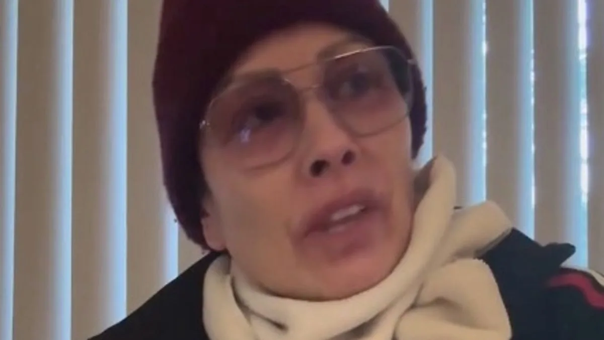 Mel Sykes says she's now 'two-thirds bald' due to autoimmune illness