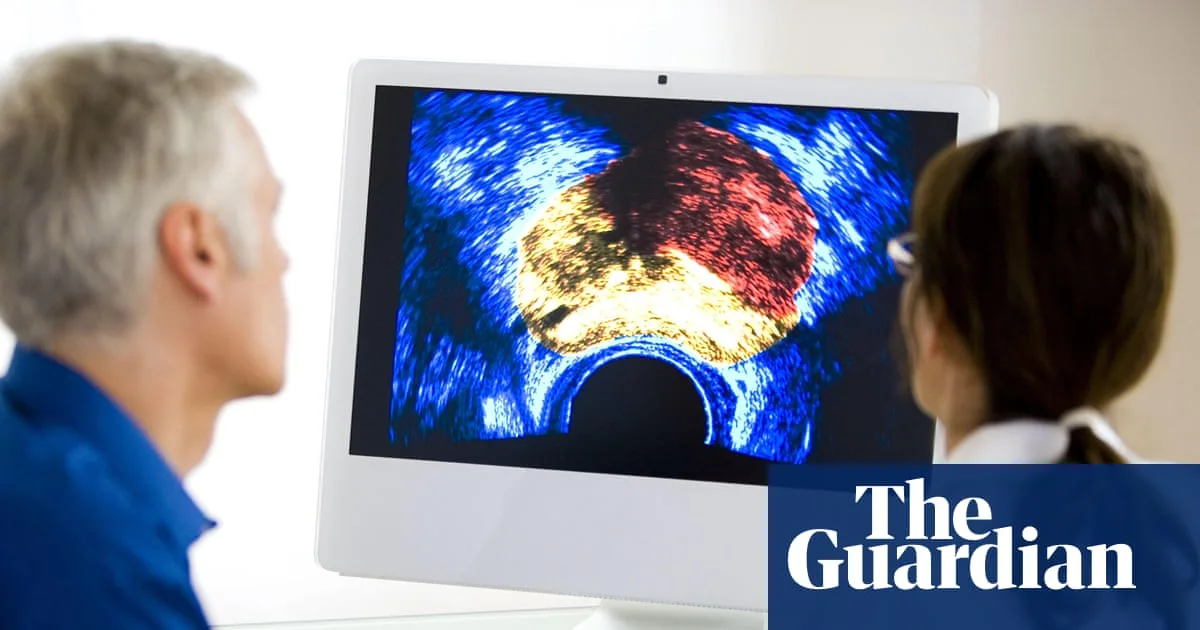 Ministers May Overrule Prostate Cancer Screening Rejection