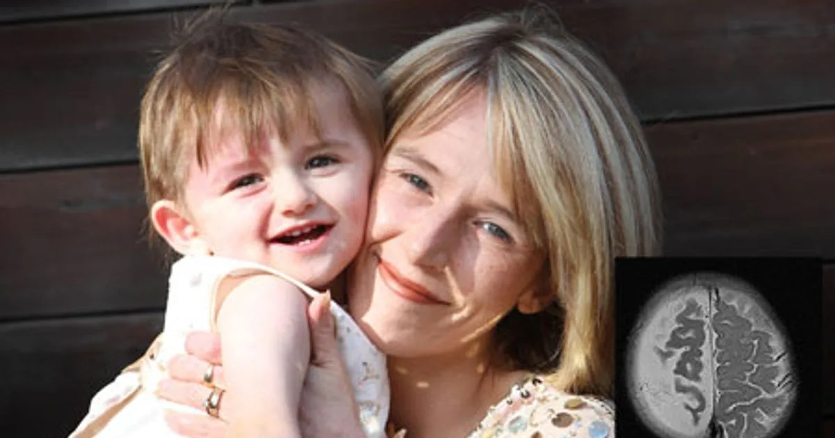 Miracle Baby Survives with Half a Brain After Life-Saving Surgery