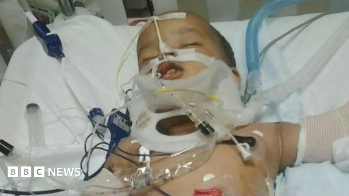 Toddler Survives 11-Storey Fall from Balcony in Minnesota