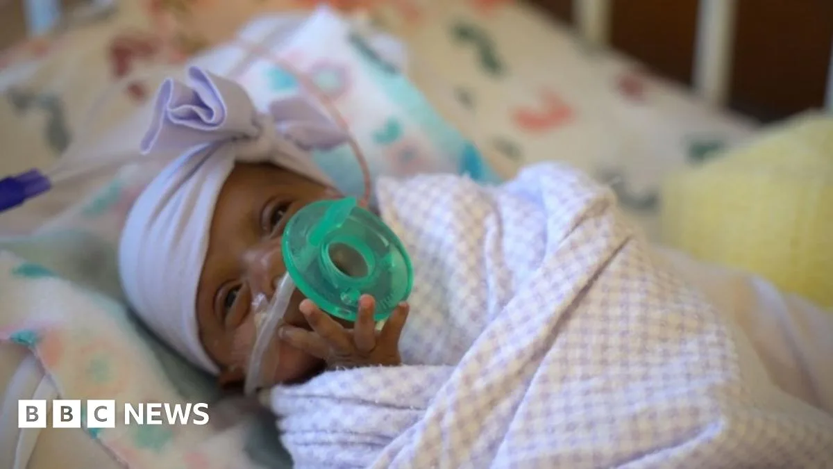 Tiniest Surviving Premature Baby Discharged from US Hospital