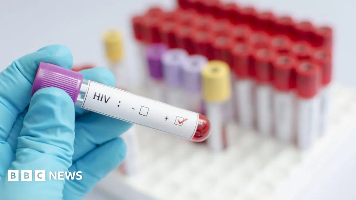 HIV Vaccine Shows Promise in Human Trials