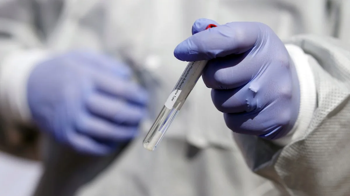 Gonorrhoea Becoming 'Untreatable' as Antibiotic-Resistant Cases Rise in England