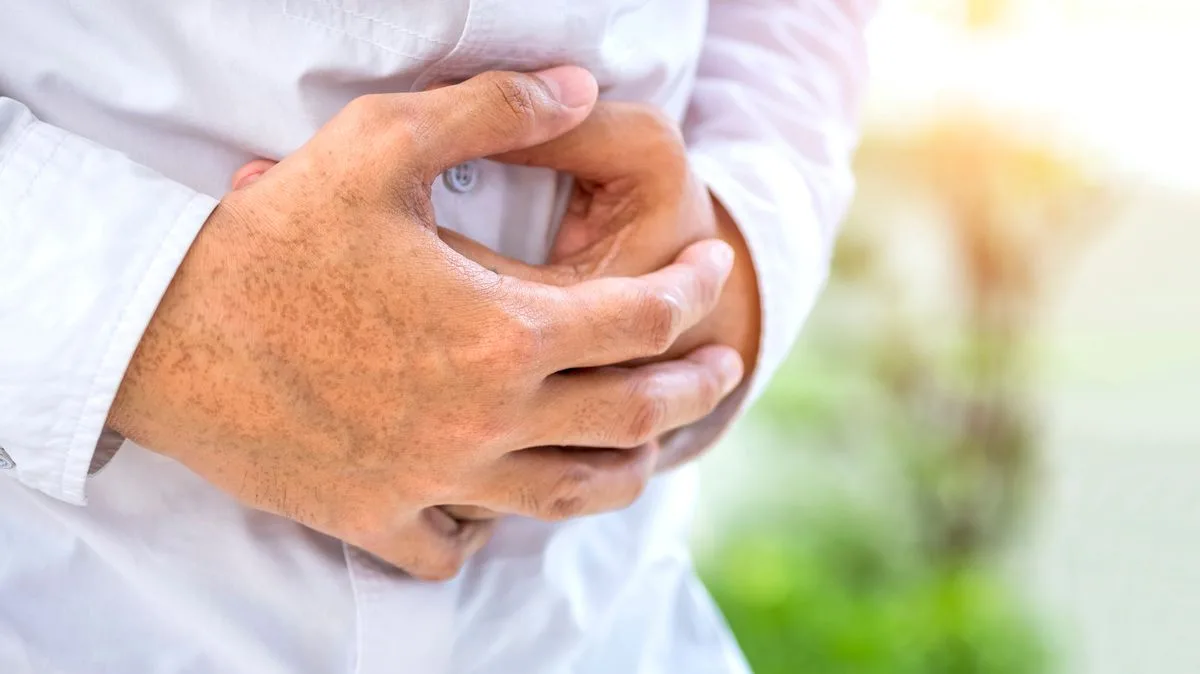 Bowel Cancer Survivor Shares Four Early Warning Signs She Missed