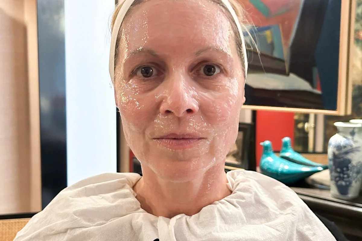 Non-Surgical Facelift: My Surprising Results