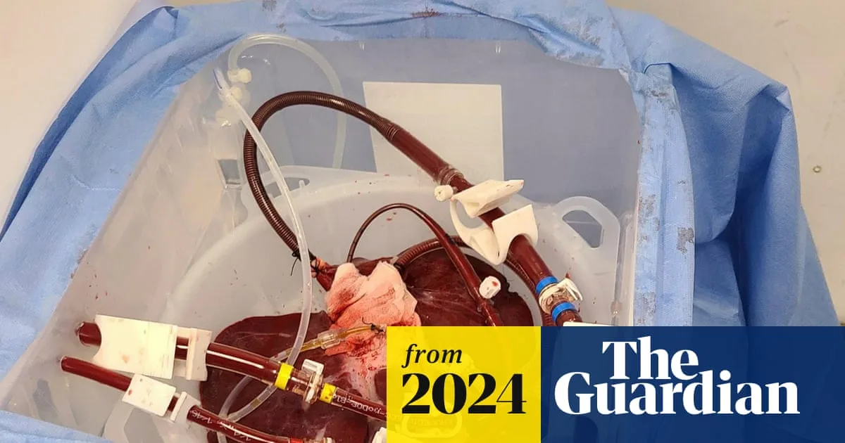 Pig Liver Filters Human Blood in External Medical Breakthrough