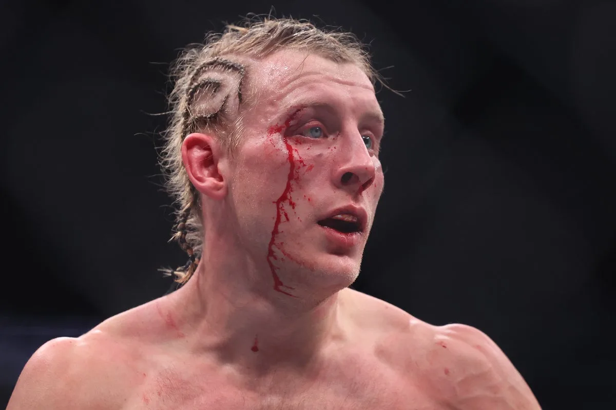 Paddy Pimblett Bloodied and Beaten by Justin Gaethje in UFC Title Fight
