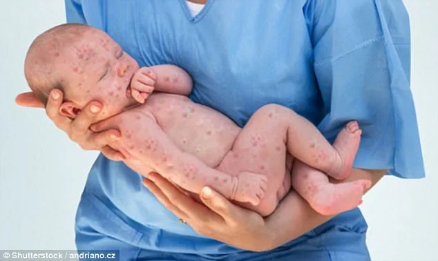 Measles Outbreak Fears in Queensland After Infected Adult Visits Wildlife Sanctuary