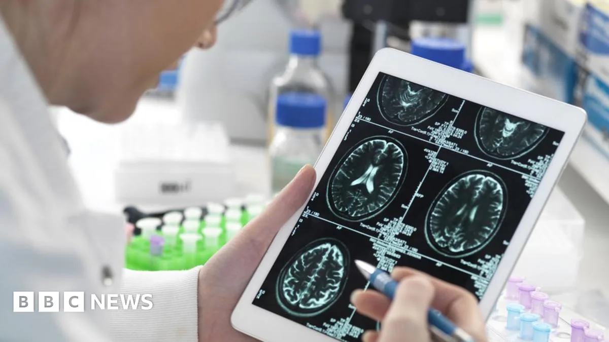 Scottish Firm Develops Early Alzheimer's Detection Method