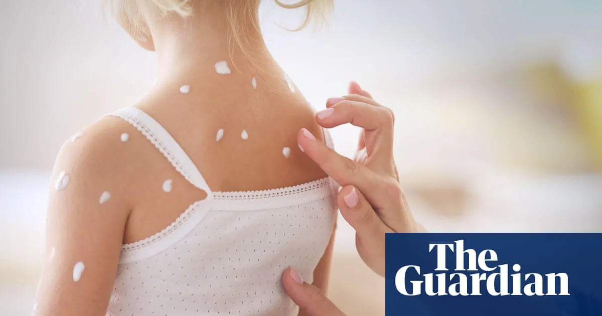 Seeing Sick People Triggers Immune Response, Study Finds