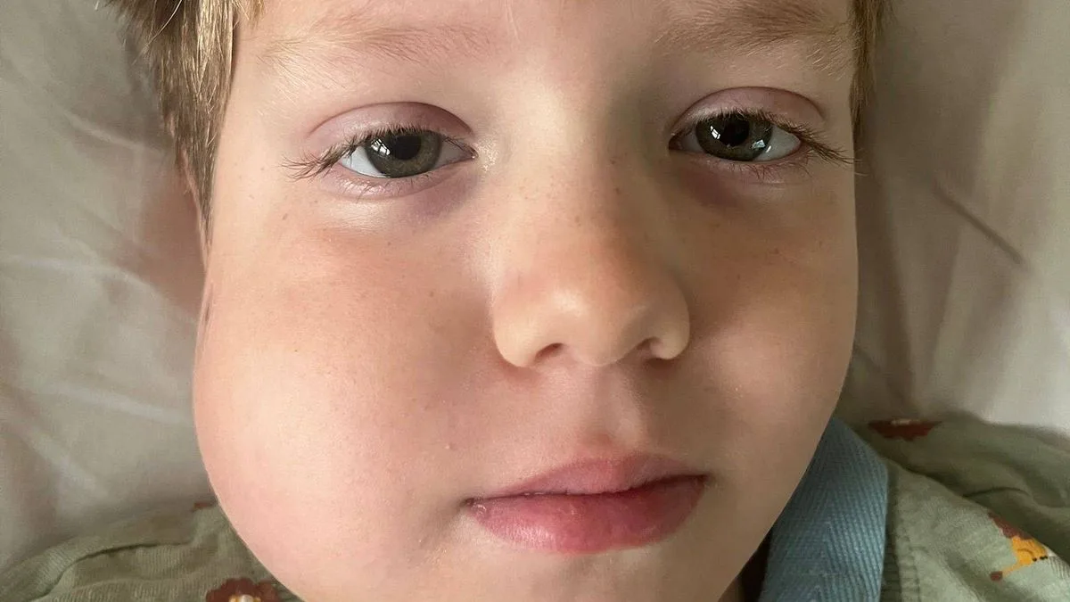 Wobbly Tooth Led to Rare Cancer Diagnosis for Seven-Year-Old Boy