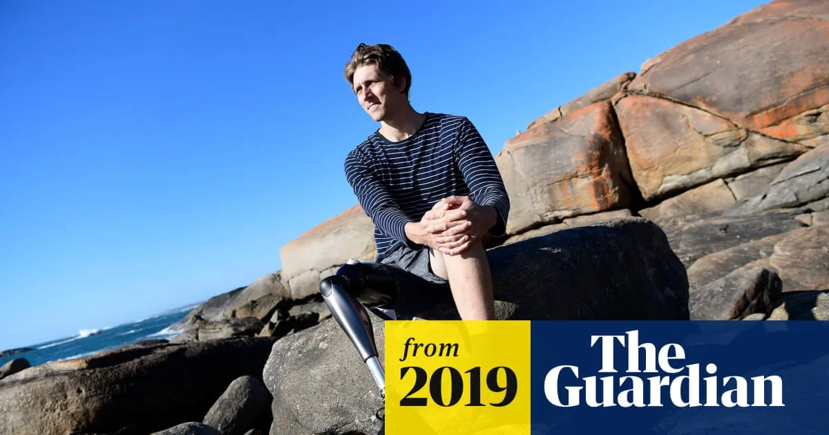 Surfer's Miraculous Escape in Brutal Shark Attack Off Western Australia