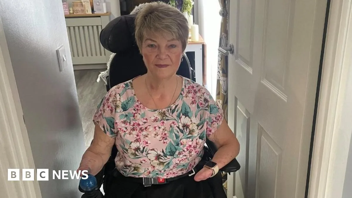 Sepsis amputee says she has no dignity in tiny Milton Keynes home