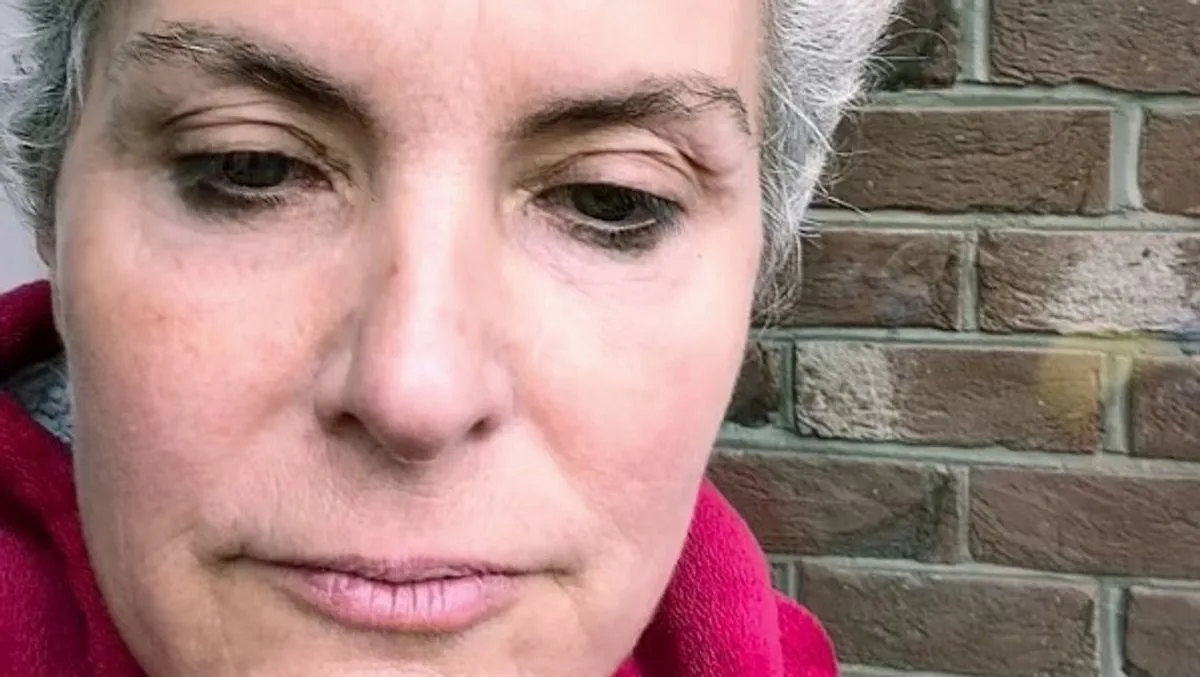 Coronation Street Star Tracy Shaw Bravely Faces Hair Loss Amid Chemotherapy