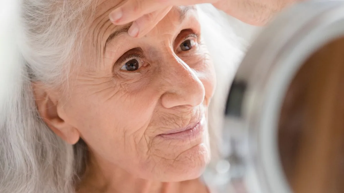 Two Facial Signs of 'Silent Killer' High Cholesterol