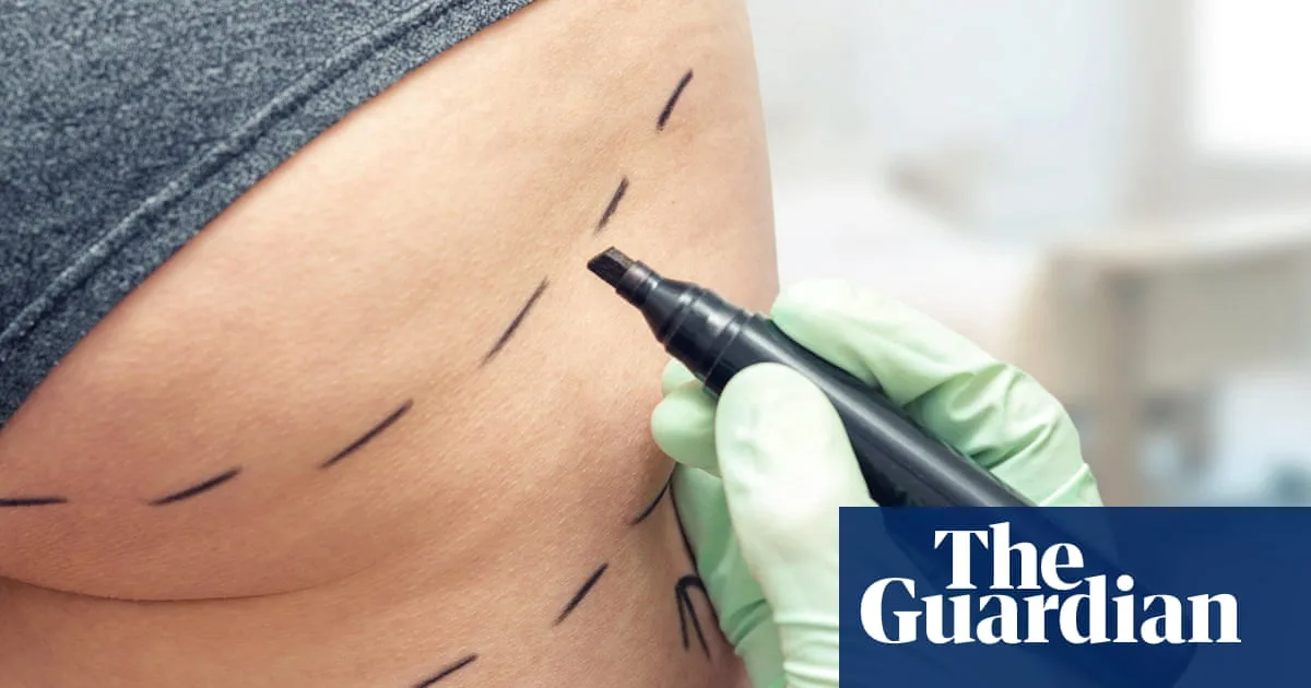 MPs Call for Ban on Brazilian Butt Lifts Amid 'Wild West' Cosmetic Industry