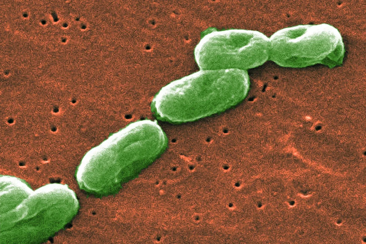 Urgent Recall: Deadly Bacteria Found in DermaRite Hand Soap