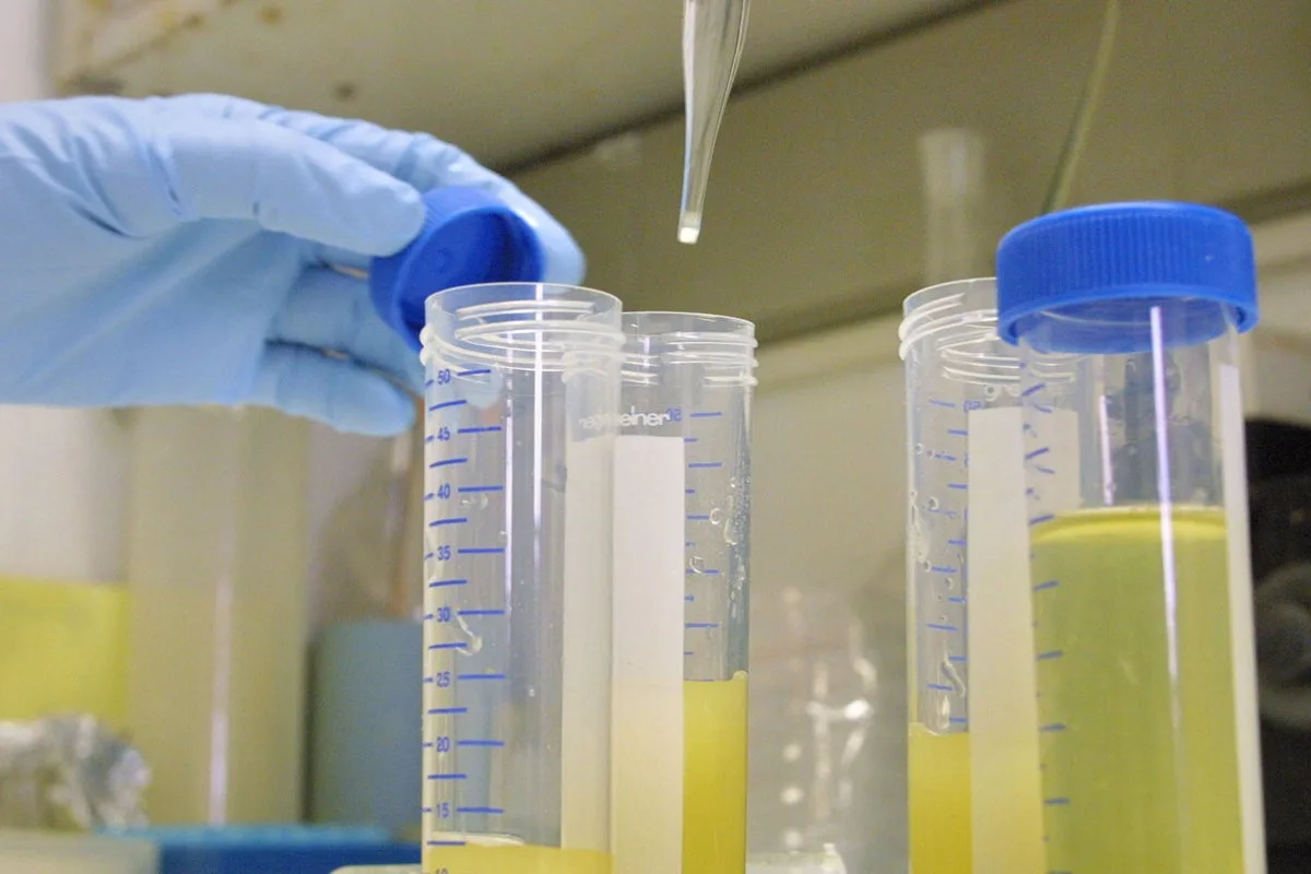 New Urine Test for 'Zombie Cells' Could Detect Lung Cancer Early on NHS