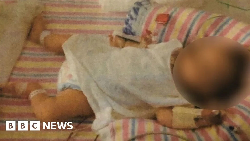 Vegan Australian Couple Who Starved Baby Avoid Jail